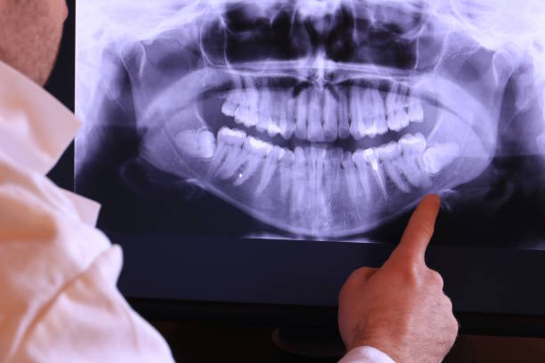 Best Emergency Treatment for Toothache in Mapleton, IA