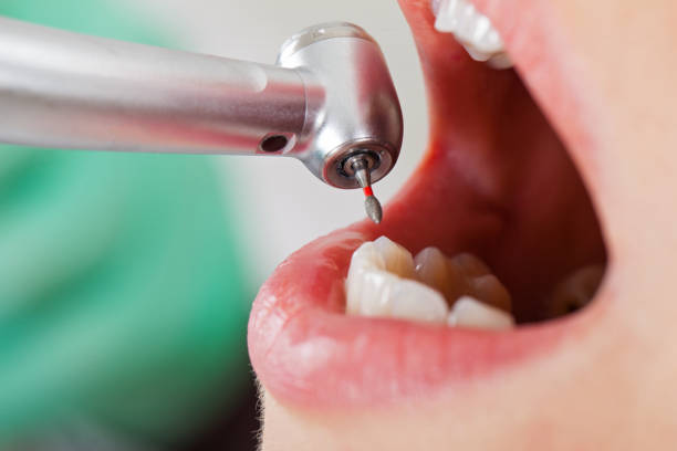 Best Emergency Broken Tooth Repair in Mapleton, IA
